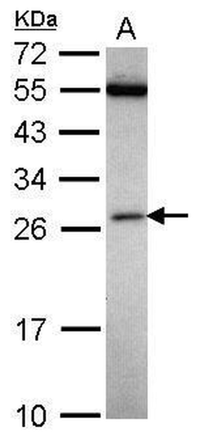 FAAP24 Antibody in Western Blot (WB)