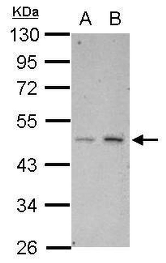 HTRA3 Antibody in Western Blot (WB)