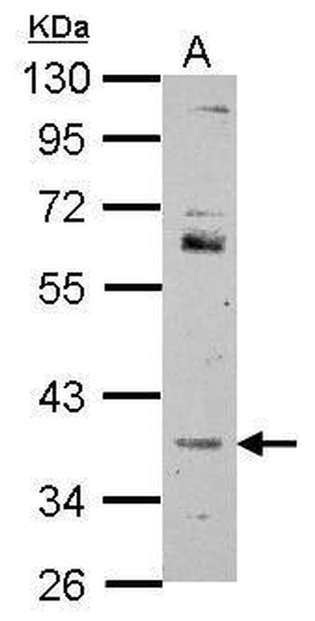 FOXR2 Antibody in Western Blot (WB)