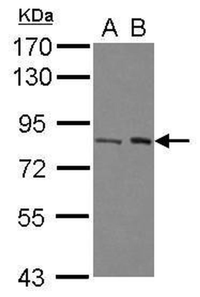 BAAT1 Antibody in Western Blot (WB)
