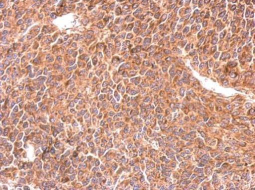 RIT1 Antibody in Immunohistochemistry (Paraffin) (IHC (P))