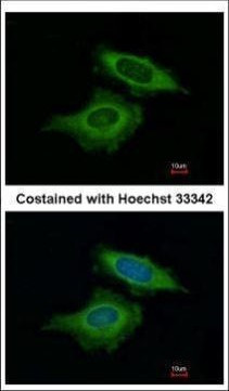 BAG2 Antibody in Immunocytochemistry (ICC/IF)