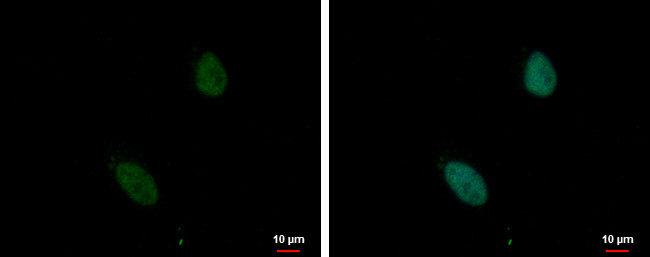 ZNF124 Antibody in Immunocytochemistry (ICC/IF)