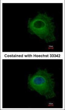 PNP Antibody in Immunocytochemistry (ICC/IF)