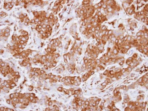 FEZ1 Antibody in Immunohistochemistry (Paraffin) (IHC (P))