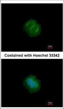 Tankyrase Antibody in Immunocytochemistry (ICC/IF)