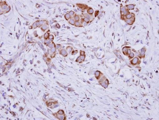 TMPRSS13 Antibody in Immunohistochemistry (Paraffin) (IHC (P))