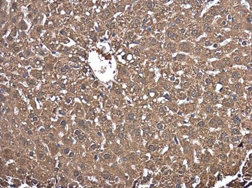 NAMPT Antibody in Immunohistochemistry (Paraffin) (IHC (P))