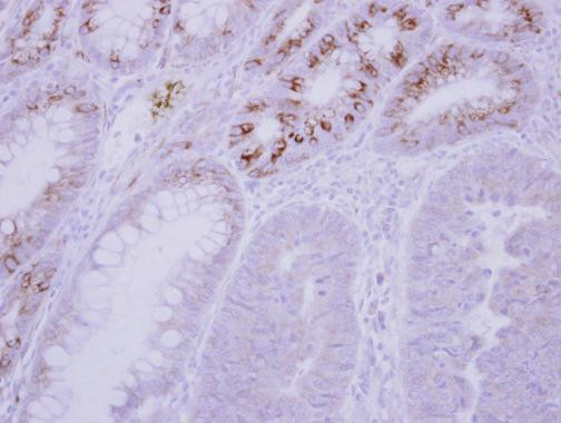 GCKR Antibody in Immunohistochemistry (Paraffin) (IHC (P))