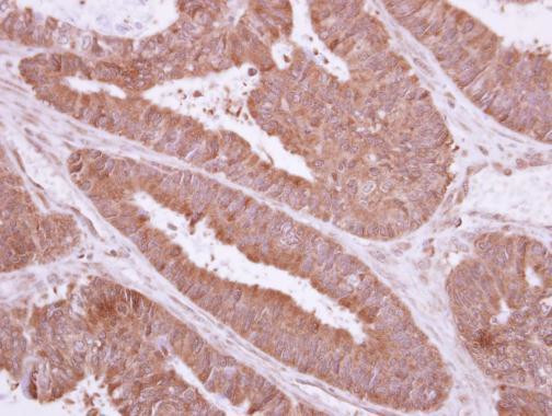 TXNDC6 Antibody in Immunohistochemistry (Paraffin) (IHC (P))