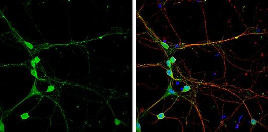 CLIP1 Antibody in Immunocytochemistry (ICC/IF)