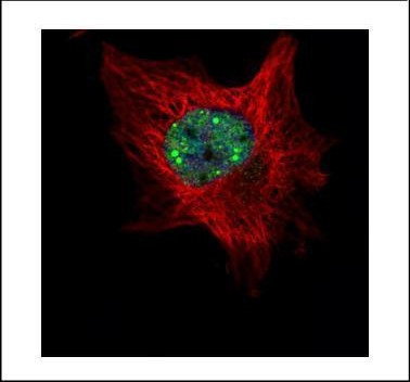 TOE1 Antibody in Immunocytochemistry (ICC/IF)