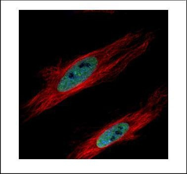 HP1 gamma Antibody in Immunocytochemistry (ICC/IF)
