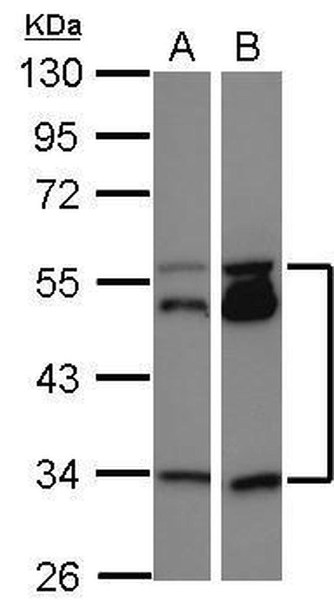 MEIS2 Antibody in Western Blot (WB)