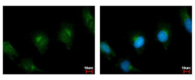 PLA2G4A Antibody in Immunocytochemistry (ICC/IF)