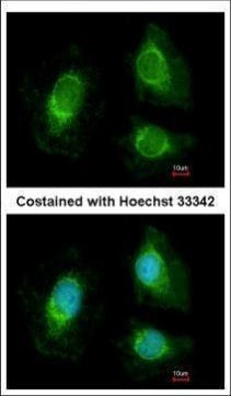 RRP4 Antibody in Immunocytochemistry (ICC/IF)