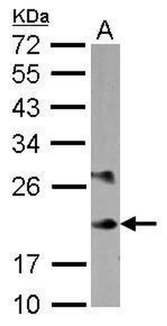 MYL6B Antibody in Western Blot (WB)