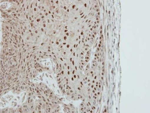 MA2 Antibody in Immunohistochemistry (Paraffin) (IHC (P))