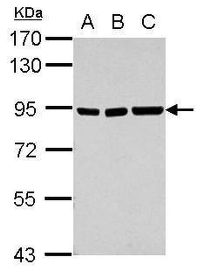 ZNF31 Antibody in Western Blot (WB)