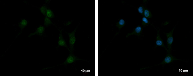 EBF3 Antibody in Immunocytochemistry (ICC/IF)
