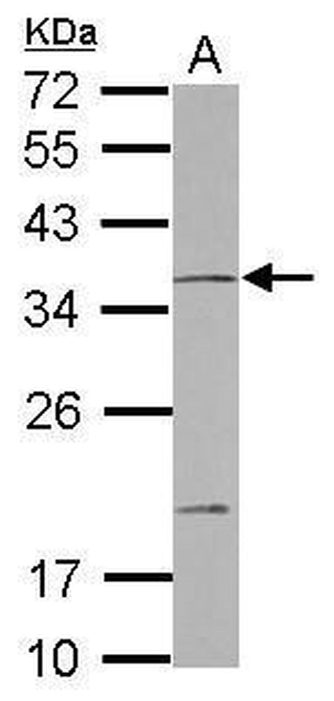 NOTCH2NL Antibody in Western Blot (WB)