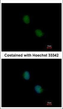 PSMB7 Antibody in Immunocytochemistry (ICC/IF)