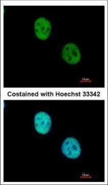 WDR4 Antibody in Immunocytochemistry (ICC/IF)