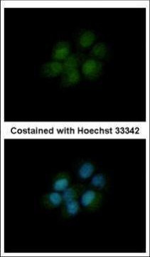 DHFR Antibody in Immunocytochemistry (ICC/IF)