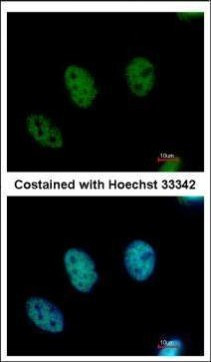 CDYL Antibody in Immunocytochemistry (ICC/IF)
