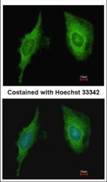 CRIP2 Antibody in Immunocytochemistry (ICC/IF)