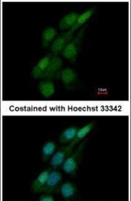 TRIM62 Antibody in Immunocytochemistry (ICC/IF)