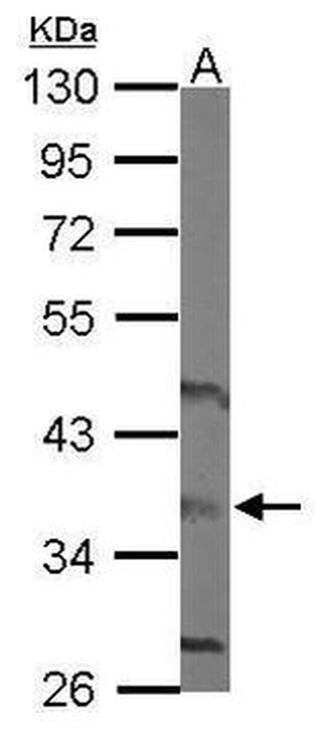 HAPLN3 Antibody in Western Blot (WB)