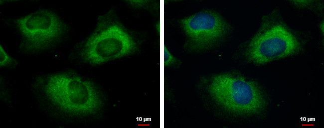 UBC3B Antibody in Immunocytochemistry (ICC/IF)