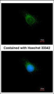 PAT1 Antibody in Immunocytochemistry (ICC/IF)
