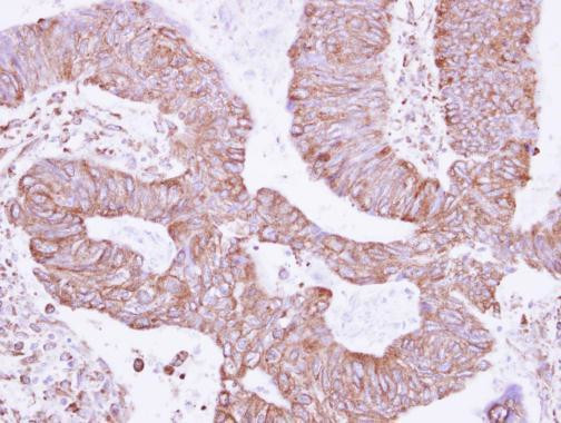 RNF181 Antibody in Immunohistochemistry (Paraffin) (IHC (P))