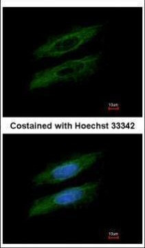 GSDMB Antibody in Immunocytochemistry (ICC/IF)