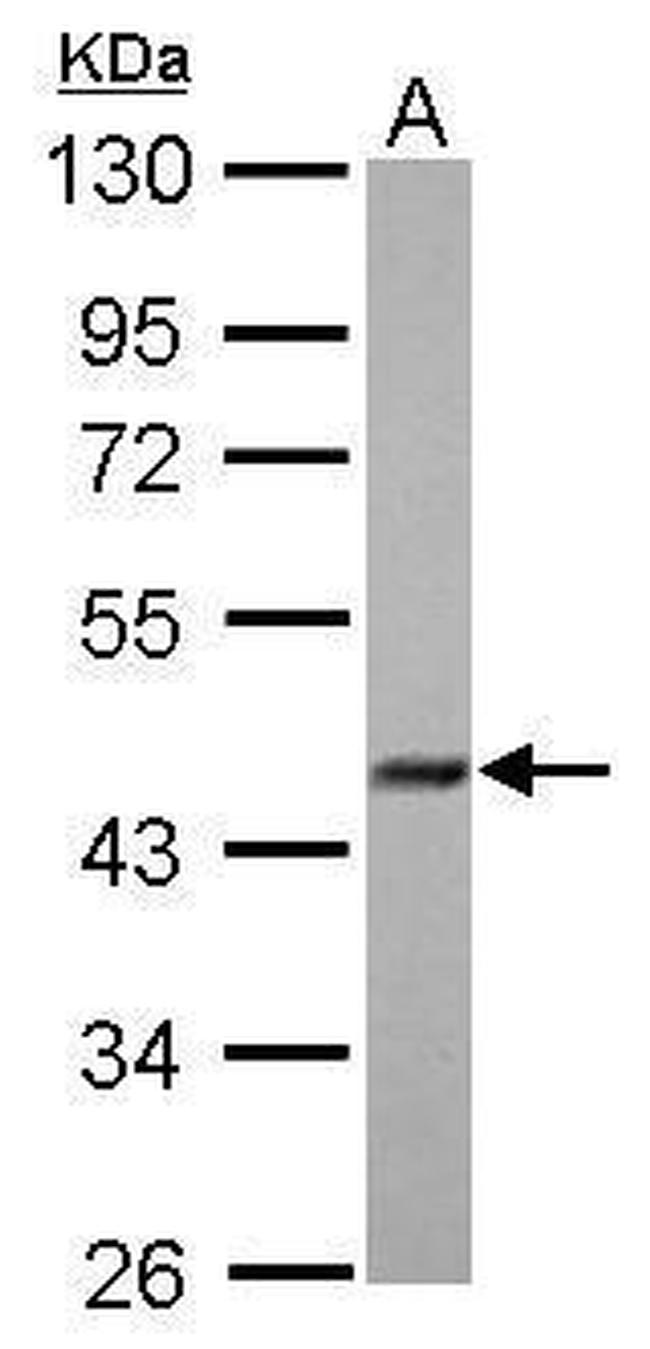FBXO22 Antibody in Western Blot (WB)