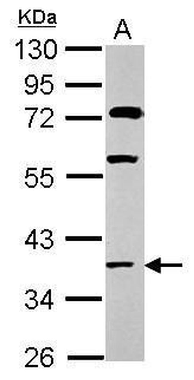 HOXC13 Antibody in Western Blot (WB)