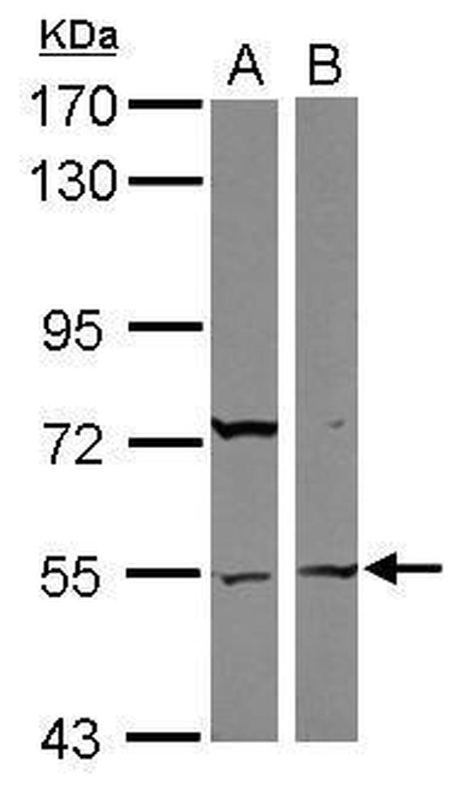 ASB3 Antibody in Western Blot (WB)
