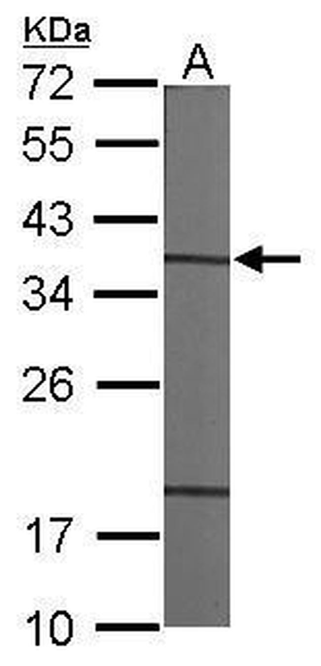 CAPZA1 Antibody in Western Blot (WB)