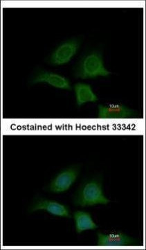 EXOC4 Antibody in Immunocytochemistry (ICC/IF)