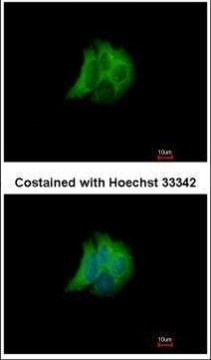 RAB17 Antibody in Immunocytochemistry (ICC/IF)