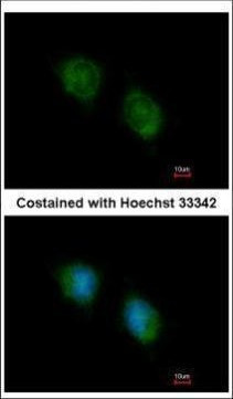 COPS4 Antibody in Immunocytochemistry (ICC/IF)