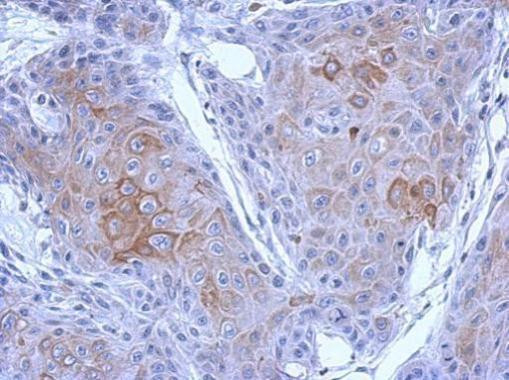 PCDH10 Antibody in Immunohistochemistry (Paraffin) (IHC (P))