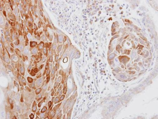 COL14A1 Antibody in Immunohistochemistry (Paraffin) (IHC (P))