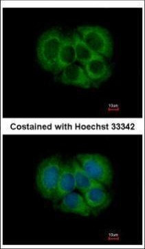 FGFR1OP2 Antibody in Immunocytochemistry (ICC/IF)