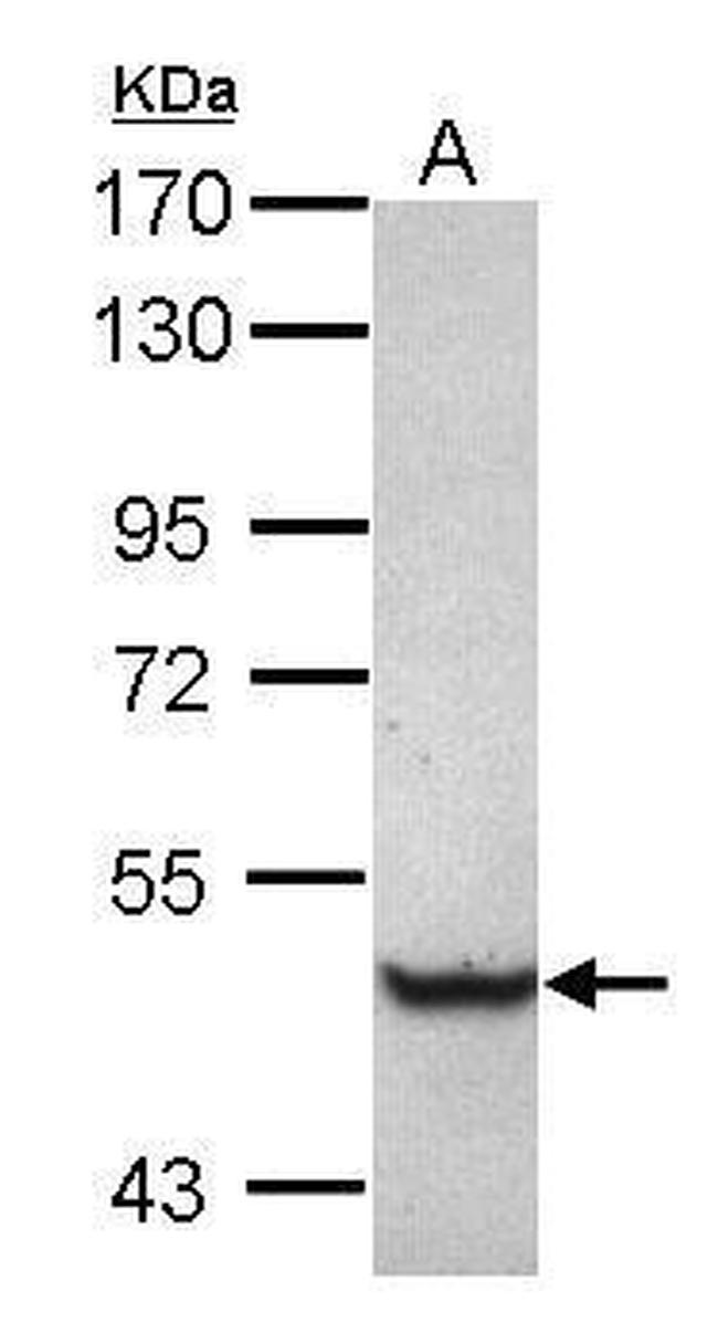 TRIM68 Antibody in Western Blot (WB)