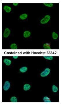 SENP3 Antibody in Immunocytochemistry (ICC/IF)