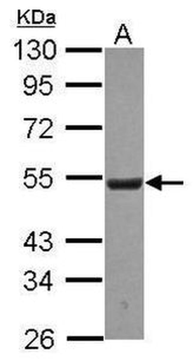 UHMK1 Antibody in Western Blot (WB)