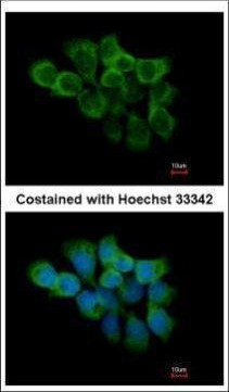 Cyclophilin F Antibody in Immunocytochemistry (ICC/IF)